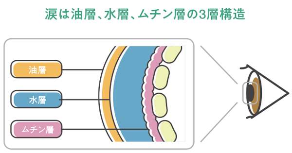 ドライアイのIPL光治療