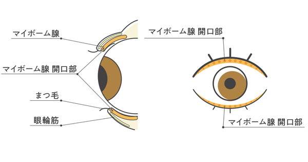 ドライアイのIPL光治療