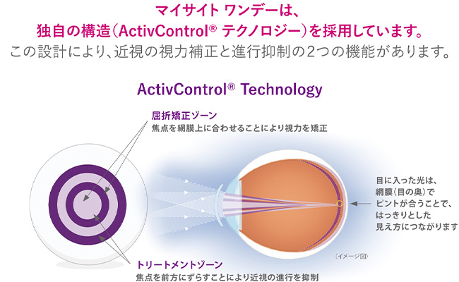 マイサイトワンデーは、独自の構造を採用しています